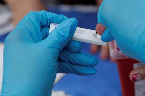 Científicos españoles logran ‘eliminar’ el VIH en un paciente por segunda vez en el mundo
